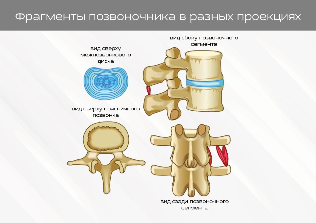 Корешковым синдромом. Корешковый синдром поясничного отдела позвоночника. Соединение позвонков. Что такое корешковый синдром позвоночника. Корешковый канал позвоночника.